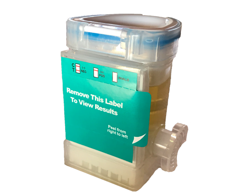 Urine Sample Collection